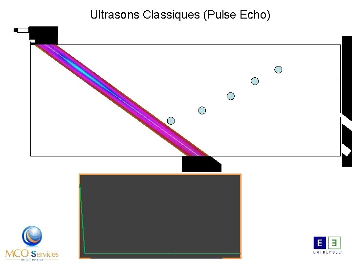 Ultrasons Classiques (Pulse Echo) 