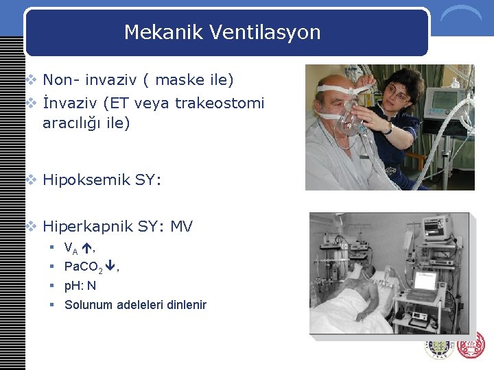 Mekanik Ventilasyon v Non- invaziv ( maske ile) v İnvaziv (ET veya trakeostomi aracılığı