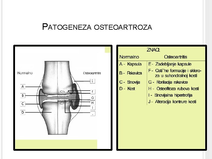 osteoartroza prehrana