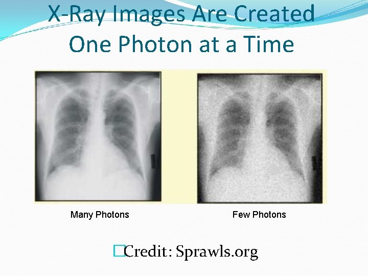 X-Ray Images Are Created One Photon at a Time Many Photons Few Photons �Credit: