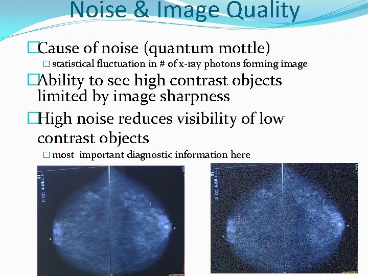 Noise & Image Quality �Cause of noise (quantum mottle) � statistical fluctuation in #