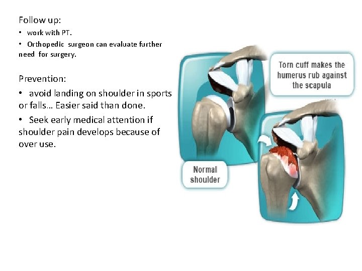 Follow up: • work with PT. • Orthopedic surgeon can evaluate further need for