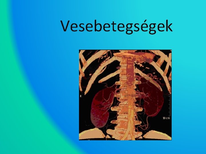 Vesebetegségek 