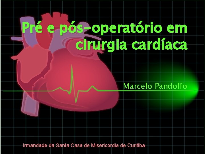 Pré e pós-operatório em cirurgia cardíaca Marcelo Pandolfo Irmandade da Santa Casa de Misericórdia