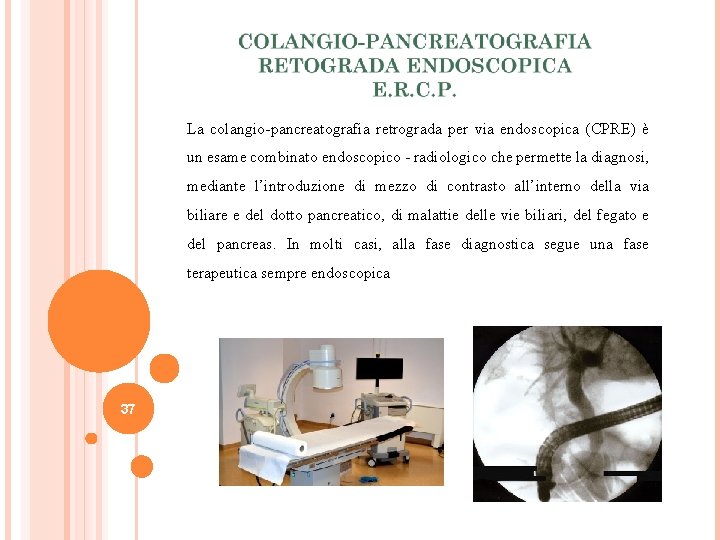 La colangio-pancreatografia retrograda per via endoscopica (CPRE) è un esame combinato endoscopico - radiologico