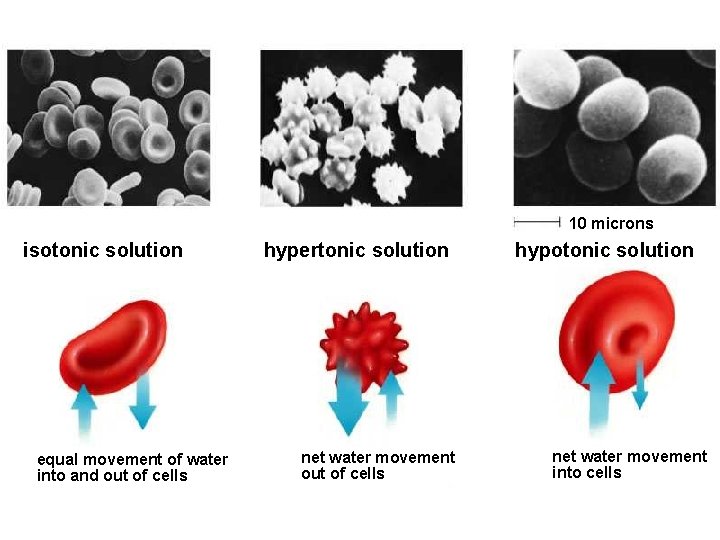 10 microns isotonic solution equal movement of water into and out of cells hypertonic