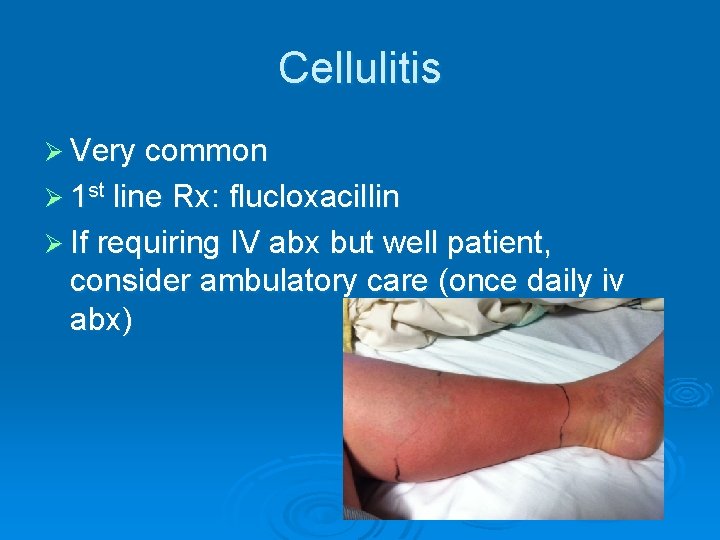 Cellulitis Ø Very common Ø 1 st line Rx: flucloxacillin Ø If requiring IV