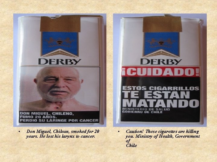 • Don Miguel, Chilean, smoked for 20 years. He lost his larynx to • Don Miguel, Chilean, smoked for 20 years. He lost his larynx to