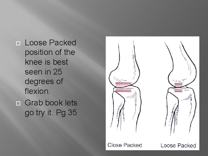  Loose Packed position of the knee is best seen in 25 degrees of