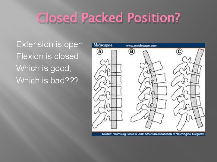 Closed Packed Position? Extension is open Flexion is closed Which is good, Which is