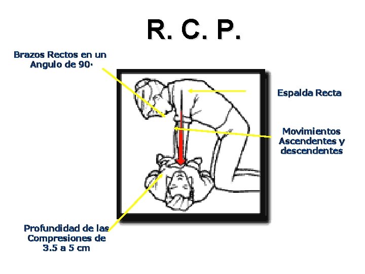 R. C. P. Brazos Rectos en un Angulo de 90· Espalda Recta Movimientos Ascendentes