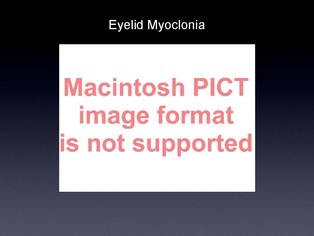 Eyelid Myoclonia 