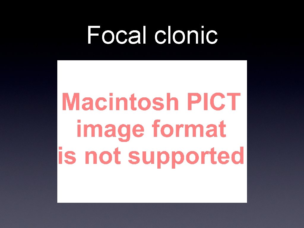 Focal clonic 