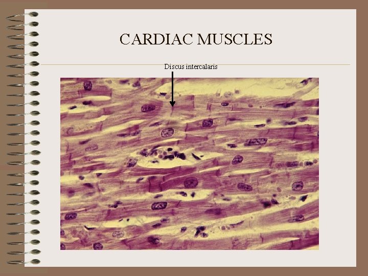CARDIAC MUSCLES Discus intercalaris CARDIAC MUSCLES Discus intercalaris