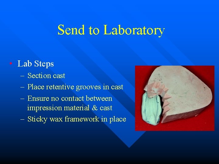 Send to Laboratory • Lab Steps – Section cast – Place retentive grooves in