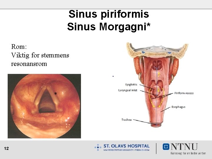 Sinus piriformis Sinus Morgagni* Rom: Viktig for stemmens resonansrom 12 