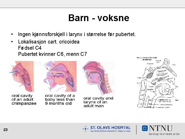 Barn - voksne • Ingen kjønnsforskjell i larynx i størrelse før pubertet. • Lokalisasjon