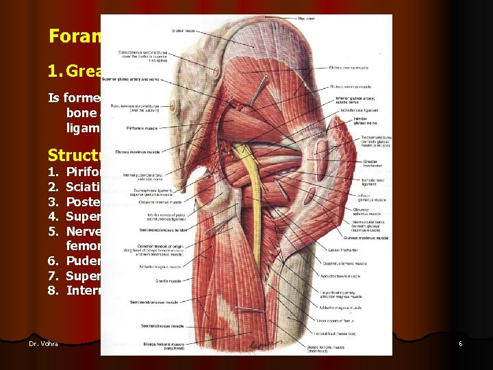 Foramina of the Gluteal Region 1. Greater Sciatic Foramen Is formed by the greater