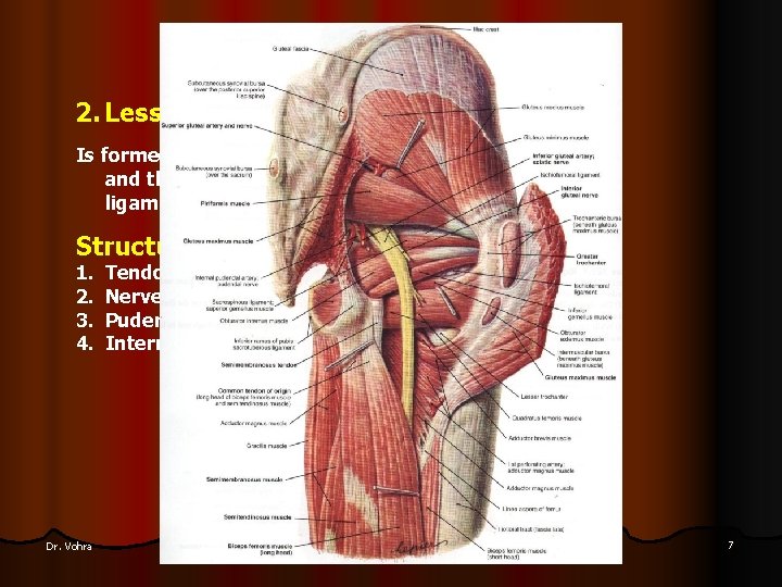 2. Lesser Sciatic Foramen Is formed by the lesser sciatic notch of the hip