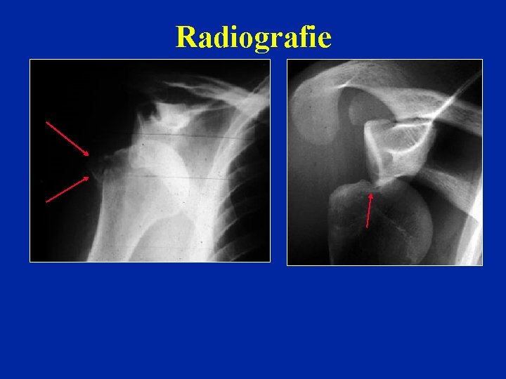 Radiografie Radiografie