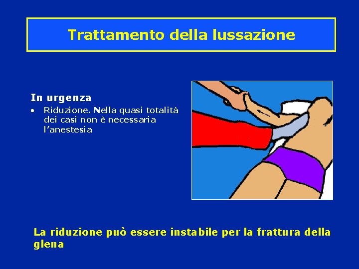 Trattamento della lussazione In urgenza • Riduzione. Nella quasi totalità dei casi non è Trattamento della lussazione In urgenza • Riduzione. Nella quasi totalità dei casi non è
