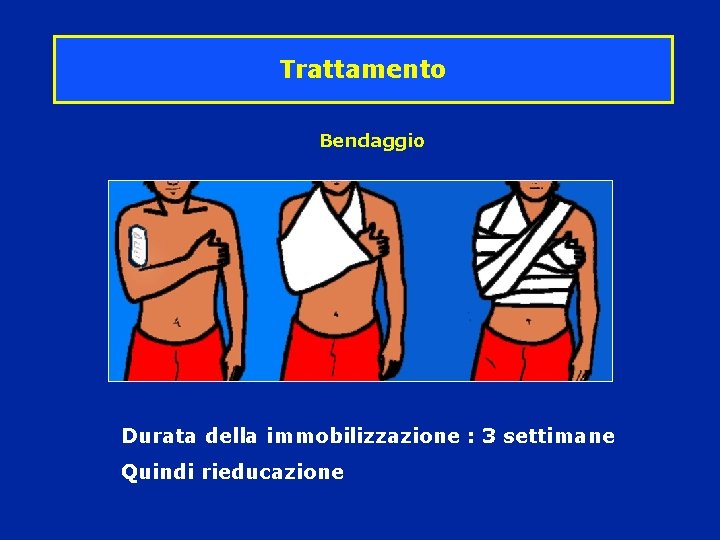Trattamento Bendaggio Durata della immobilizzazione : 3 settimane Quindi rieducazione Trattamento Bendaggio Durata della immobilizzazione : 3 settimane Quindi rieducazione