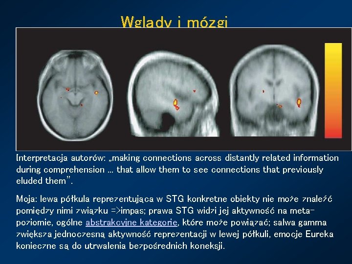 Wglądy i mózgi Można badać aktywność mózgu w czasie rozwiązywania problemów, które wymagają wglądu