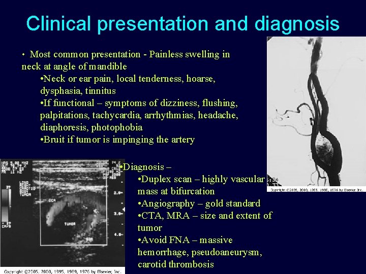 Clinical presentation and diagnosis • Most common presentation - Painless swelling in neck at