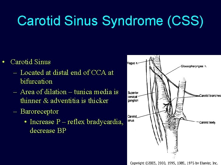 Carotid Sinus Syndrome (CSS) • Carotid Sinus – Located at distal end of CCA