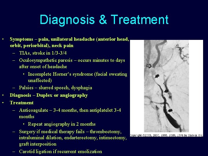 Diagnosis & Treatment • • • Symptoms – pain, unilateral headache (anterior head, orbit,