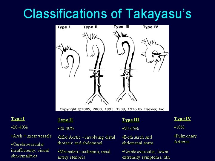 Classifications of Takayasu’s Type III Type IV • 20 -40% • 50 -65% •