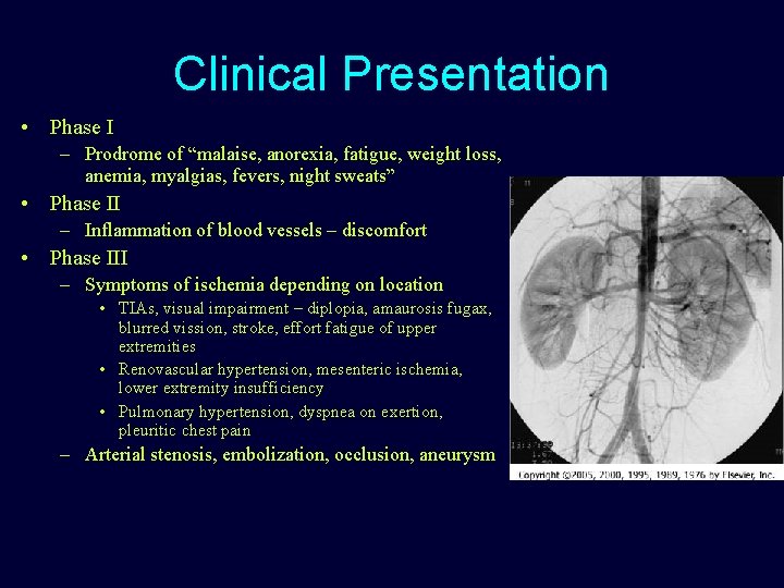 Clinical Presentation • Phase I – Prodrome of “malaise, anorexia, fatigue, weight loss, anemia,