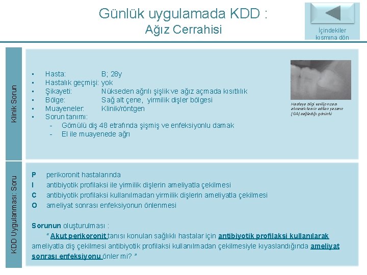 Günlük uygulamada KDD : KDD Uygulanması: Soru Klinik Sorun Ağız Cerrahisi • • • Günlük uygulamada KDD : KDD Uygulanması: Soru Klinik Sorun Ağız Cerrahisi • • •