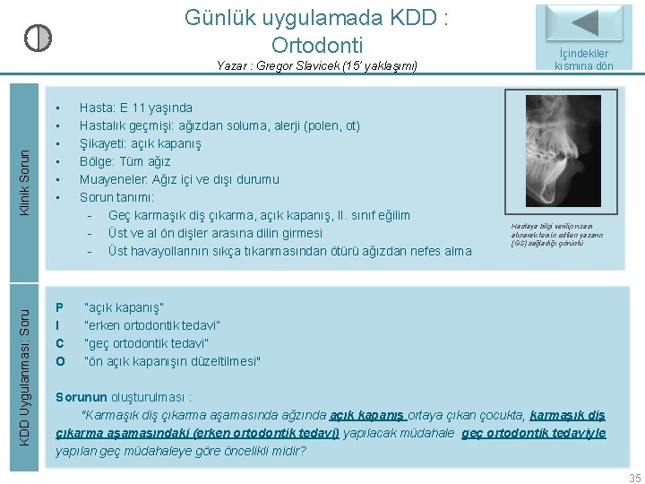 Günlük uygulamada KDD : Ortodonti KDD Uygulanması: Soru Klinik Sorun Yazar : Gregor Slavicek Günlük uygulamada KDD : Ortodonti KDD Uygulanması: Soru Klinik Sorun Yazar : Gregor Slavicek
