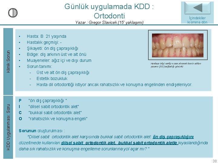 Günlük uygulamada KDD : Ortodonti KDD Uygulanması: Soru Klinik Sorun Yazar : Gregor Slavicek Günlük uygulamada KDD : Ortodonti KDD Uygulanması: Soru Klinik Sorun Yazar : Gregor Slavicek