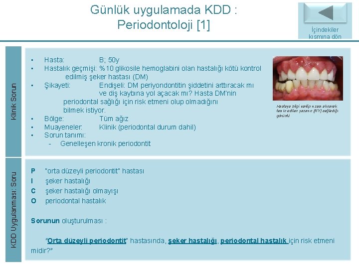 Günlük uygulamada KDD : Periodontoloji [1] KDD Uygulanması: Soru Klinik Sorun • • •