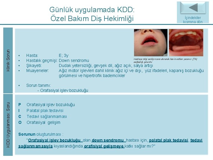 Klinik Sorun Günlük uygulamada KDD: Özel Bakım Diş Hekimliği • • KDD Uygulanması: Soru Klinik Sorun Günlük uygulamada KDD: Özel Bakım Diş Hekimliği • • KDD Uygulanması: Soru