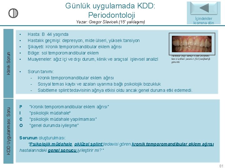 Günlük uygulamada KDD: Periodontoloji KDD Uygulanması: Soru Klinik Sorun Yazar: Gregor Slavicek (15’ yaklaşımı) Günlük uygulamada KDD: Periodontoloji KDD Uygulanması: Soru Klinik Sorun Yazar: Gregor Slavicek (15’ yaklaşımı)