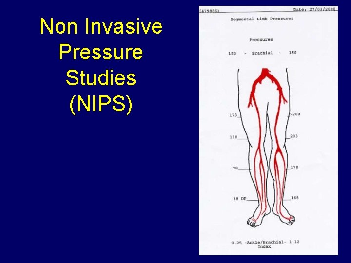 Non Invasive Pressure Studies (NIPS) 