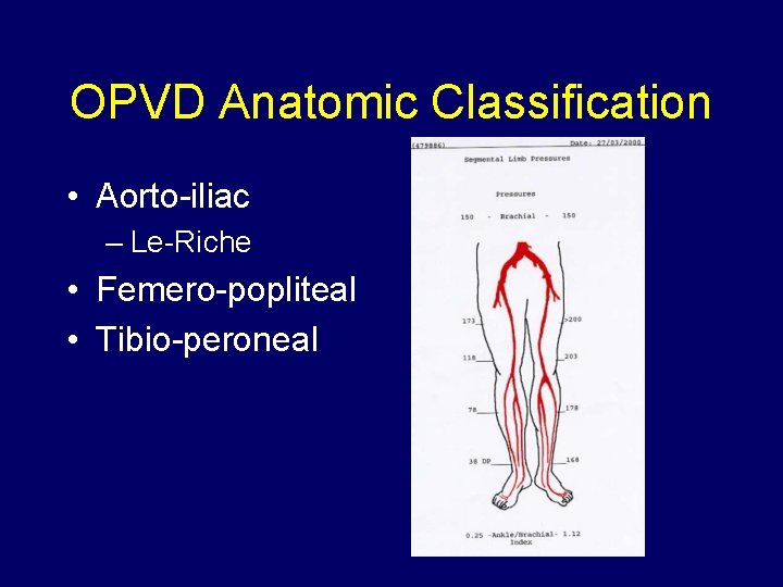 OPVD Anatomic Classification • Aorto-iliac – Le-Riche • Femero-popliteal • Tibio-peroneal 