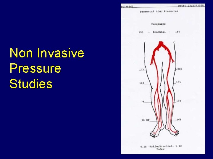 Non Invasive Pressure Studies 