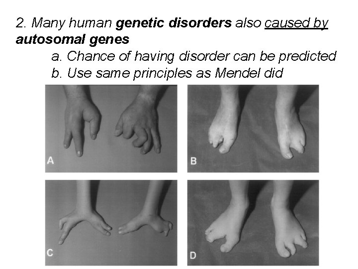 2. Many human genetic disorders also caused by autosomal genes a. Chance of having