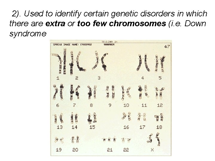  2). Used to identify certain genetic disorders in which there are extra or