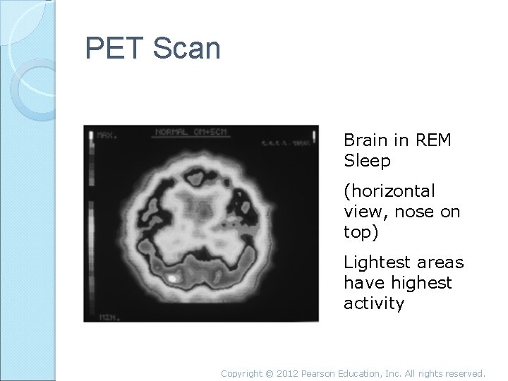 PET Scan Brain in REM Sleep (horizontal view, nose on top) Lightest areas have