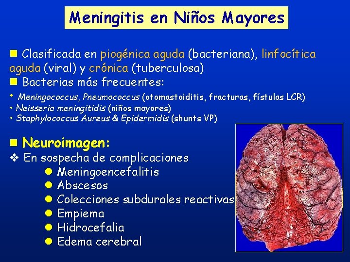 Meningitis en Niños Mayores n Clasificada en piogénica aguda (bacteriana), linfocítica aguda (viral) y Meningitis en Niños Mayores n Clasificada en piogénica aguda (bacteriana), linfocítica aguda (viral) y