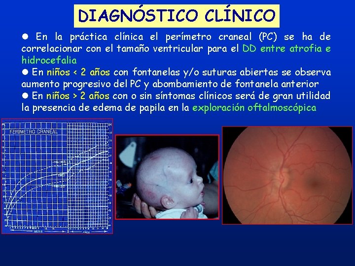 DIAGNÓSTICO CLÍNICO l En la práctica clínica el perímetro craneal (PC) se ha de DIAGNÓSTICO CLÍNICO l En la práctica clínica el perímetro craneal (PC) se ha de