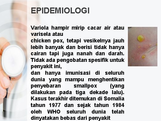 EPIDEMIOLOGI Variola hampir mirip cacar air atau varisela atau chicken pox, tetapi vesikelnya jauh