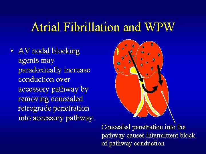 Atrial Fibrillation and WPW • AV nodal blocking agents may paradoxically increase conduction over Atrial Fibrillation and WPW • AV nodal blocking agents may paradoxically increase conduction over