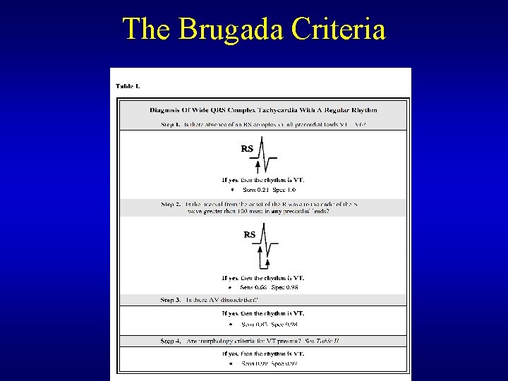 The Brugada Criteria The Brugada Criteria