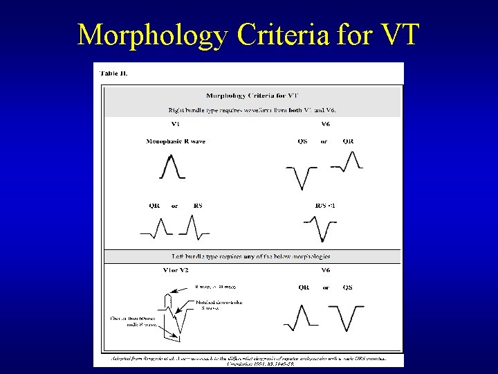 Morphology Criteria for VT Morphology Criteria for VT